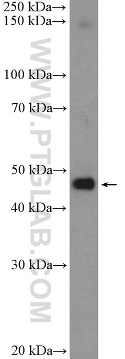 PSMD11 Rabbit anti-Human, Mouse, Rat, Polyclonal, Proteintech 150 &mu;L;