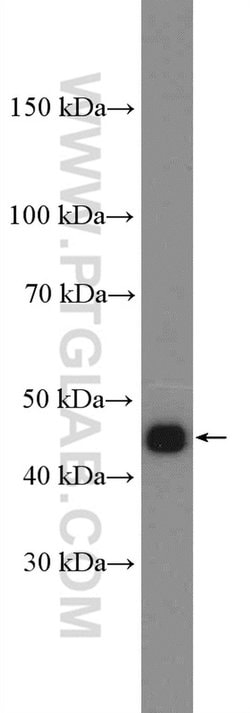 PSMD11 Rabbit anti-Human, Mouse, Rat, Polyclonal, Proteintech 150 &mu;L;
