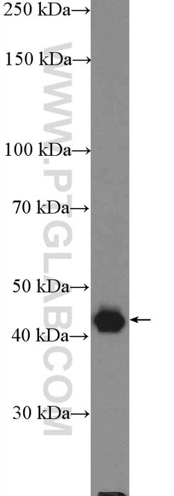 PSMD11 Rabbit anti-Human, Mouse, Rat, Polyclonal, Proteintech 150 &mu;L;