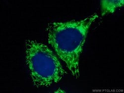 MRPL12 Rabbit anti-Human, Mouse, Rat, Polyclonal, Proteintech 150 &mu;L;