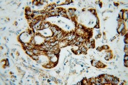 MRPL12 Rabbit anti-Human, Mouse, Rat, Polyclonal, Proteintech 150 &mu;L;