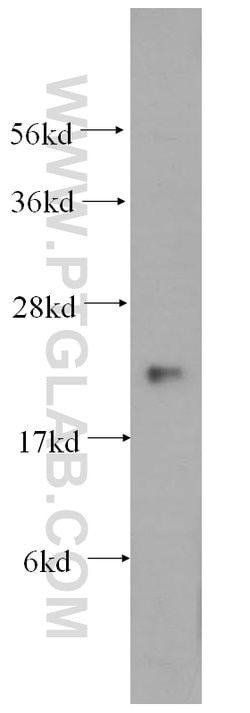 MRPL12 Rabbit anti-Human, Mouse, Rat, Polyclonal, Proteintech 150 &mu;L;