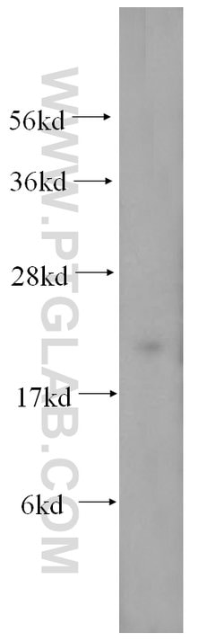 MRPL12 Rabbit anti-Human, Mouse, Rat, Polyclonal, Proteintech 150 &mu;L;