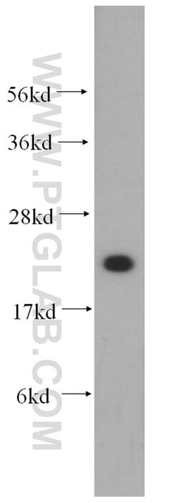 MRPL12 Rabbit anti-Human, Mouse, Rat, Polyclonal, Proteintech 150 &mu;L;