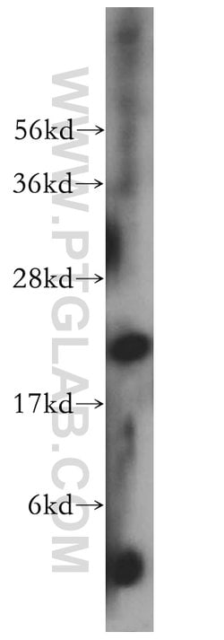 MRPL12 Rabbit anti-Human, Mouse, Rat, Polyclonal, Proteintech 150 &mu;L;