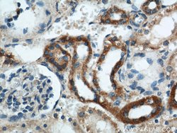 GOT2 Rabbit anti-Human, Mouse, Rat, Polyclonal, Proteintech:Anticorps:Anticorps