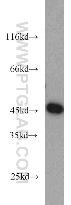 GOT2 Rabbit anti-Human, Mouse, Rat, Polyclonal, Proteintech:Anticorps:Anticorps