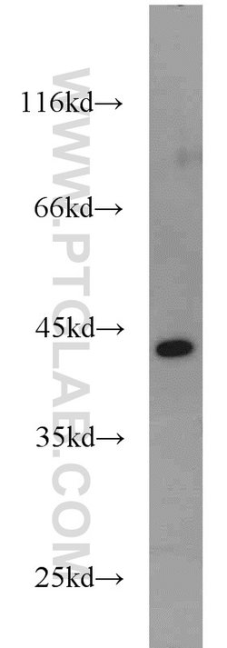 GOT2 Rabbit anti-Human, Mouse, Rat, Polyclonal, Proteintech:Anticorps:Anticorps