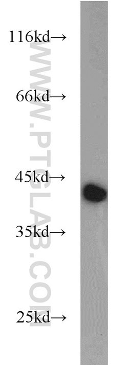 GOT2 Rabbit anti-Human, Mouse, Rat, Polyclonal, Proteintech:Anticorps:Anticorps