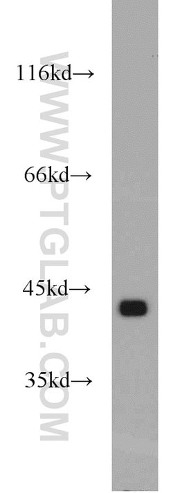 GOT2 Rabbit anti-Human, Mouse, Rat, Polyclonal, Proteintech:Anticorps:Anticorps