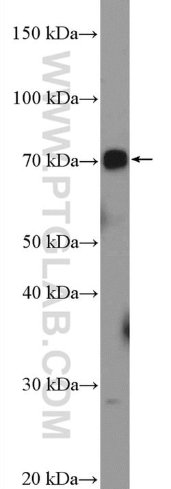 UBOX5 Rabbit anti-Human, Mouse, Rat, Polyclonal, Proteintech:Antibodies:Primary