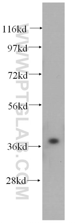 PEX16 Rabbit anti-Human, Mouse, Rat, Polyclonal, Proteintech:Antibodies:Primary