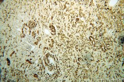 ARG2 Rabbit anti-Human, Mouse, Rat, Polyclonal, Proteintech:Antibodies:Primary
