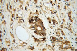 ARG2 Rabbit anti-Human, Mouse, Rat, Polyclonal, Proteintech:Antibodies:Primary