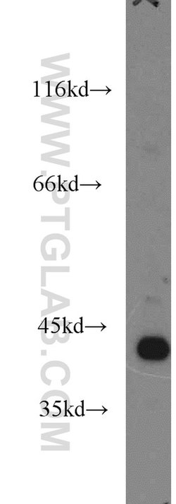 ARG2 Rabbit anti-Human, Mouse, Rat, Polyclonal, Proteintech:Antibodies:Primary