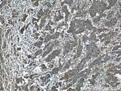 ARG2 Rabbit anti-Human, Mouse, Rat, Polyclonal, Proteintech:Antibodies:Primary