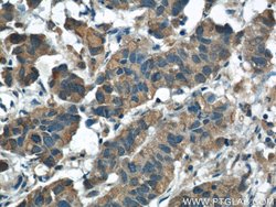 ARG2 Rabbit anti-Human, Mouse, Rat, Polyclonal, Proteintech:Antibodies:Primary