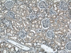 ARG2 Rabbit anti-Human, Mouse, Rat, Polyclonal, Proteintech:Antibodies:Primary