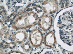 ARG2 Rabbit anti-Human, Mouse, Rat, Polyclonal, Proteintech:Antibodies:Primary