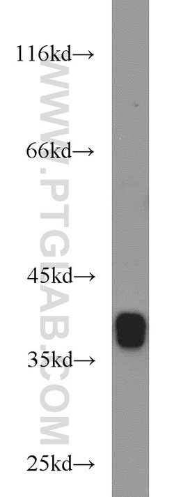 ARG2 Rabbit anti-Human, Mouse, Rat, Polyclonal, Proteintech:Antibodies:Primary