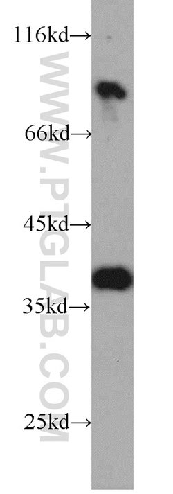 ARG2 Rabbit anti-Human, Mouse, Rat, Polyclonal, Proteintech:Antibodies:Primary