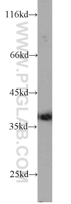 ARG2 Rabbit anti-Human, Mouse, Rat, Polyclonal, Proteintech:Antibodies:Primary