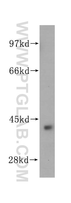 ARG2 Rabbit anti-Human, Mouse, Rat, Polyclonal, Proteintech:Antibodies:Primary