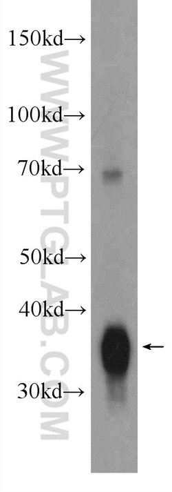 ARG2 Rabbit anti-Human, Mouse, Rat, Polyclonal, Proteintech:Antibodies:Primary