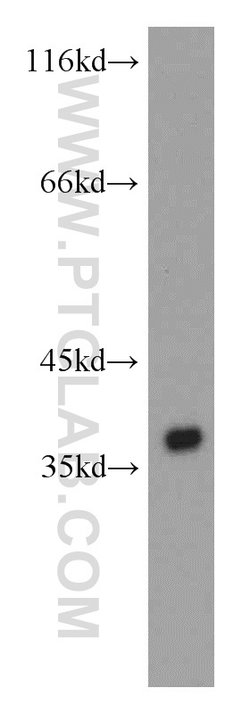 PIG3 Rabbit anti-Human, Polyclonal, Proteintech:Anticorps:Anticorps primaires
