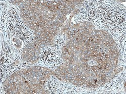 FABP7 Rabbit anti-Human, Polyclonal, Proteintech:Antibodies:Primary Antibodies