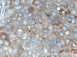 FABP7 Rabbit anti-Human, Polyclonal, Proteintech:Antibodies:Primary Antibodies