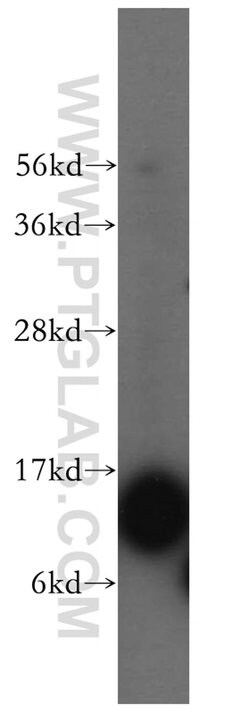 FABP7 Rabbit anti-Human, Polyclonal, Proteintech:Antibodies:Primary Antibodies