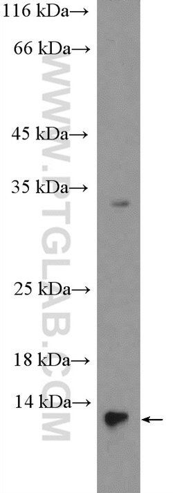 FABP7 Rabbit anti-Human, Polyclonal, Proteintech:Antibodies:Primary Antibodies