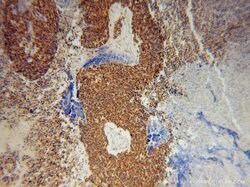 UBC9 Rabbit anti-Human, Mouse, Rat, Polyclonal, Proteintech 150 &mu;L;