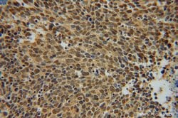 UBC9 Rabbit anti-Human, Mouse, Rat, Polyclonal, Proteintech 150 &mu;L;