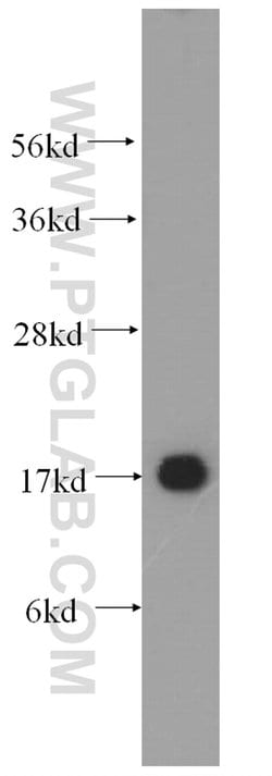 UBC9 Rabbit anti-Human, Mouse, Rat, Polyclonal, Proteintech 150 &mu;L;