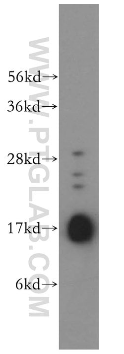 UBC9 Rabbit anti-Human, Mouse, Rat, Polyclonal, Proteintech 150 &mu;L;