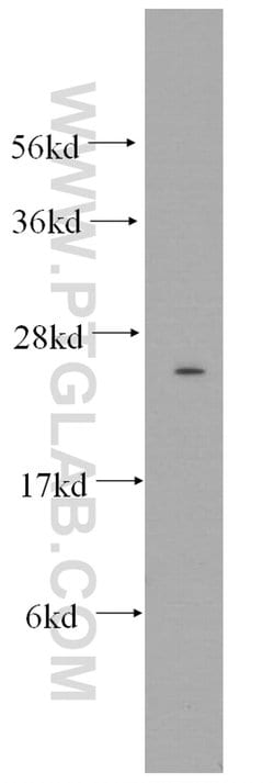 Connexin-26 Rabbit anti-Human, Mouse, Polyclonal, Proteintech 150 &mu;L;