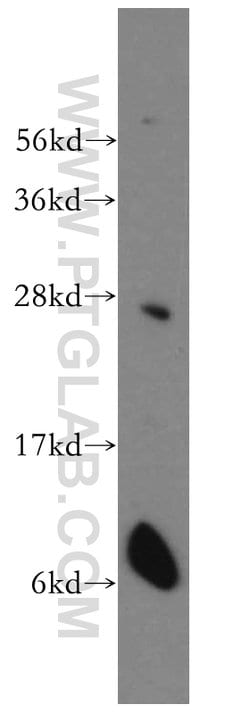 Connexin-26 Rabbit anti-Human, Mouse, Polyclonal, Proteintech 150 &mu;L;