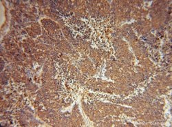 Myh9 Rabbit anti-Human, Mouse, Polyclonal, Proteintech 150 &mu;L | Buy Online | Proteintech Group Inc | Fisher Scientific