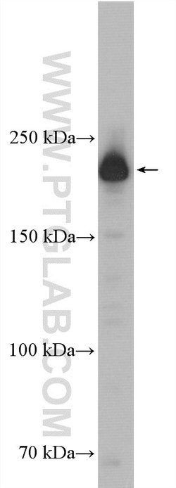 Myh9 Rabbit anti-Human, Mouse, Polyclonal, Proteintech 150 &mu;L | Buy Online | Proteintech Group Inc | Fisher Scientific
