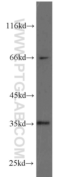 HSD17B7 Rabbit anti-Human, Mouse, Rat, Polyclonal, Proteintech 150 &mu;L;