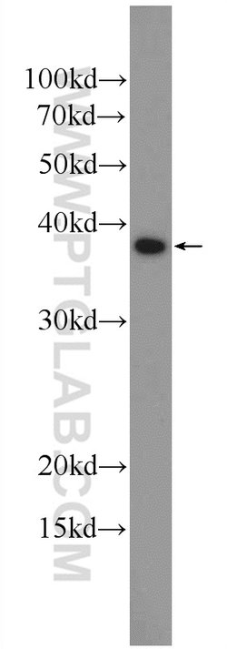 HSD17B7 Rabbit anti-Human, Mouse, Rat, Polyclonal, Proteintech 150 &mu;L;