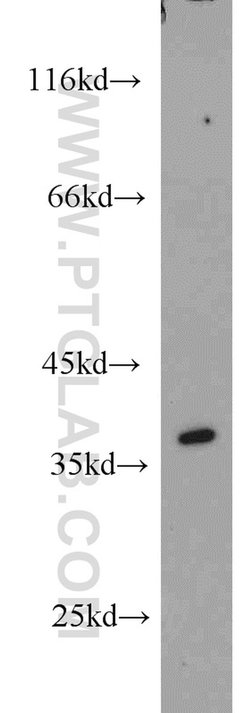 HSD17B7 Rabbit anti-Human, Mouse, Rat, Polyclonal, Proteintech 150 &mu;L;