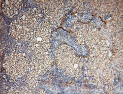 SYK Rabbit anti-Human, Mouse, Rat, Polyclonal, Proteintech 150 &mu;L; Unconjugated:Antibodies,