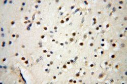 SYK Rabbit anti-Human, Mouse, Rat, Polyclonal, Proteintech 150 &mu;L; Unconjugated:Antibodies,