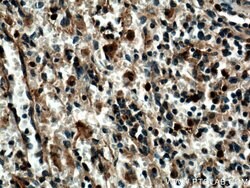 SYK Rabbit anti-Human, Mouse, Rat, Polyclonal, Proteintech 150 &mu;L; Unconjugated:Antibodies,