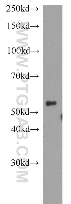 DPH2 Rabbit anti-Human, Mouse, Rat, Polyclonal, Proteintech 150 &mu;L;