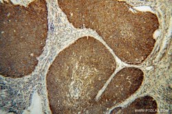 COQ9 Rabbit anti-Human, Mouse, Rat, Polyclonal, Proteintech:Antibodies:Primary