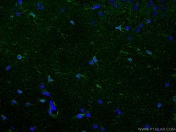 Aldolase C Rabbit anti-Human, Mouse, Rat, Polyclonal, Proteintech:Antibodies:Primary